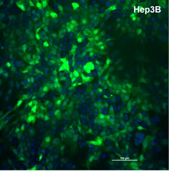 Fluorescence micrograph of Hep3B cells after eGFP mRNA transfection, showing green eGFP signal distributed across the field alongside blue DAPI-stained nuclei.